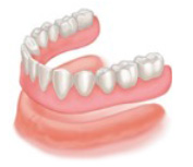 Complete lower denture